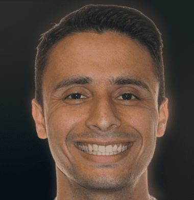 Adults patient 3 smile after orthodontic treatment