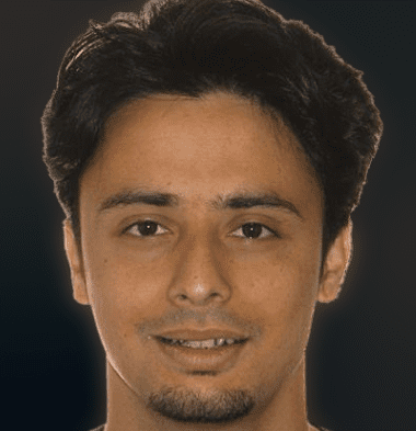 Adults patient 3 smile before orthodontic treatment