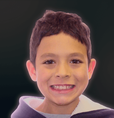 Kids patient 5 smile before orthodontic treatment