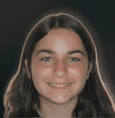 Teens patient 2 smile before orthodontic treatment
