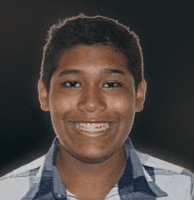 Teens patient 4 smile before orthodontic treatment